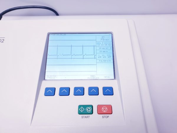 Schiller AT-102 plus - EKG - mit Patientenkabel – Bild 7
