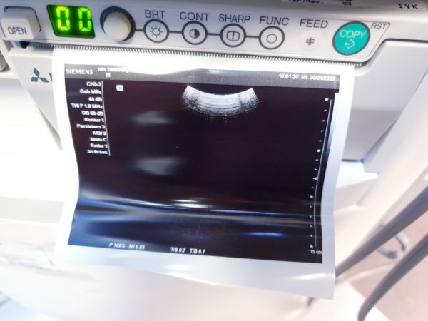 Siemens Acuson X300  X 300 Premium Edition – + CH5-2 Konvex  + EC9-4 Endovaginal  -- – Bild 8