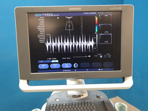 Siemens Acuson X300  X 300 Premium Edition – + CH5-2 Konvex  + EC9-4 Endovaginal  -- – Bild 22