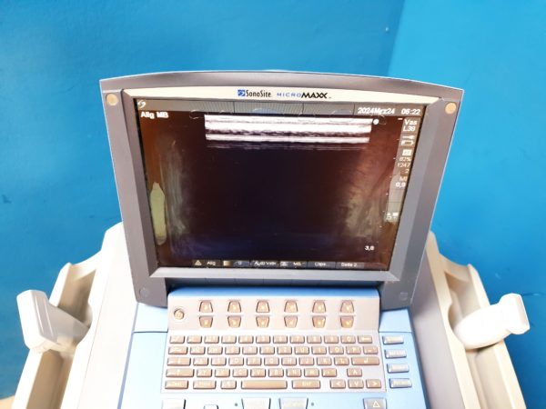 Sonosite MicroMaxx + L25e13-6 MHz + L38e10-5 MHz + P17 5-1MHz – Bild 17