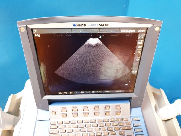 Sonosite MicroMaxx + L25e13-6 MHz + L38e10-5 MHz + P17 5-1MHz – Bild 22