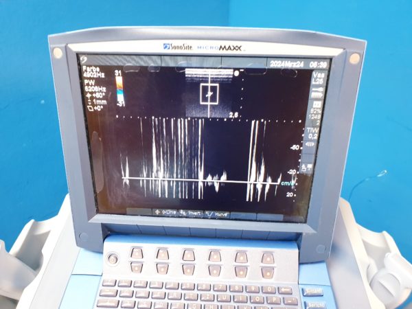 Sonosite MicroMaxx + L25e13-6 MHz + L38e10-5 MHz + P17 5-1MHz – Bild 24