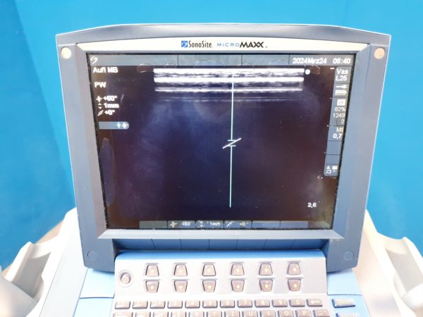 Sonosite MicroMaxx + L25e13-6 MHz + L38e10-5 MHz + P17 5-1MHz – Bild 27