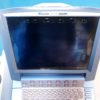 Sonosite MicroMaxx + L25e13-6 MHz + L38e10-5 MHz + P17 5-1MHz – Bild 34