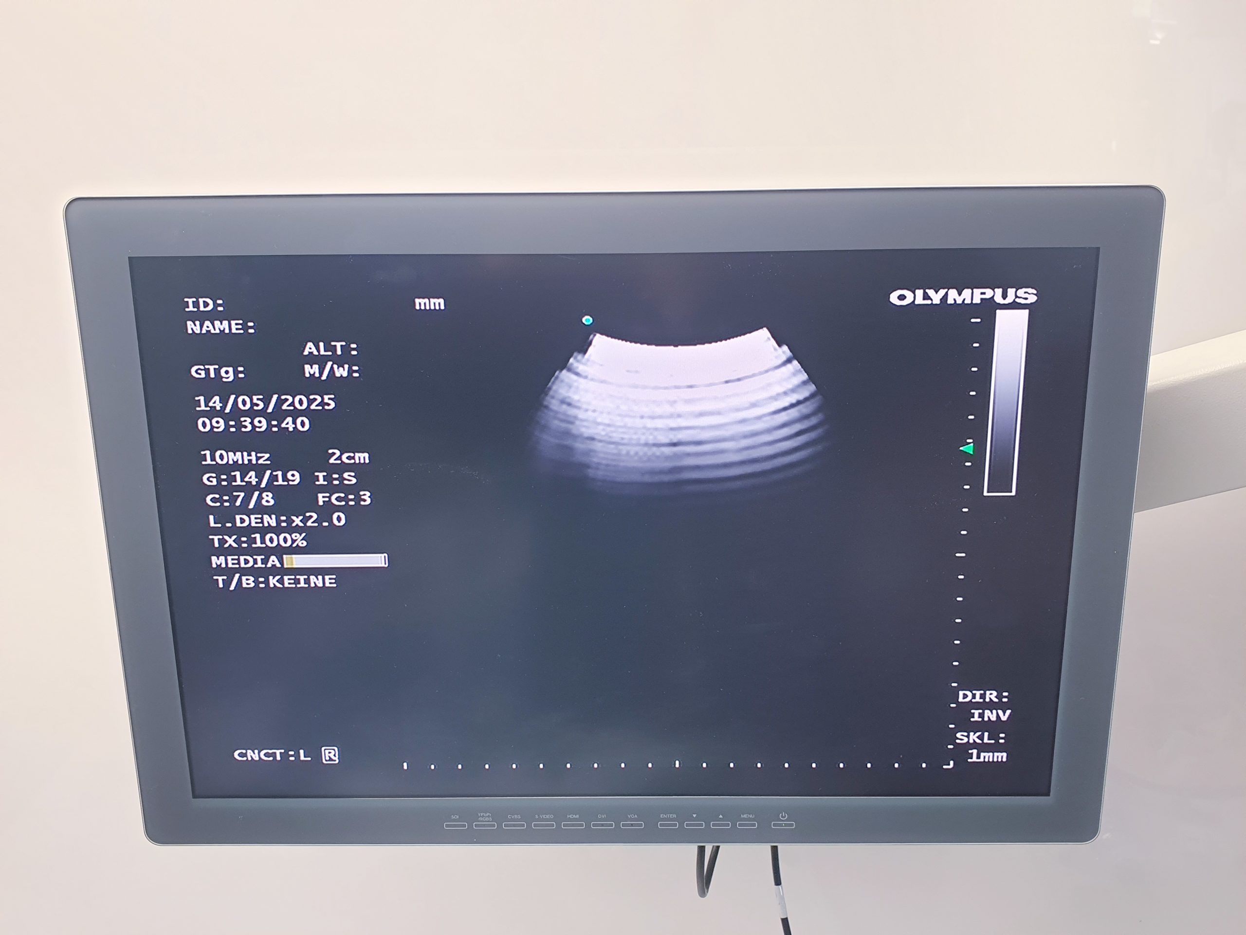 Olympus BF-UC190F Ultraschall Bronchoskope - Bronschoskop – Bild 15