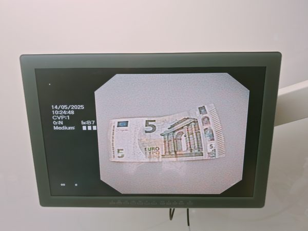 Olympus GIF-N180 Transnasales Gastroskop – Bild 15