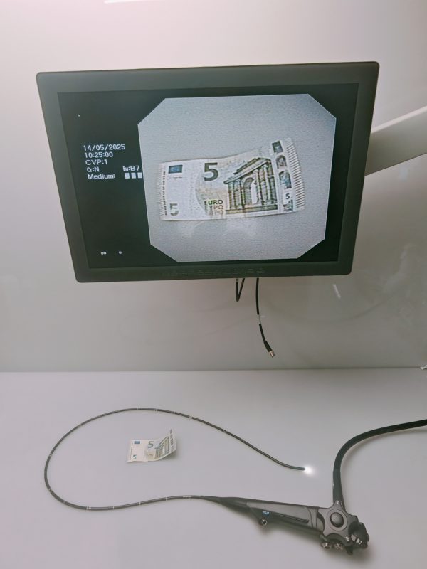 Olympus GIF-N180 Transnasales Gastroskop – Bild 16