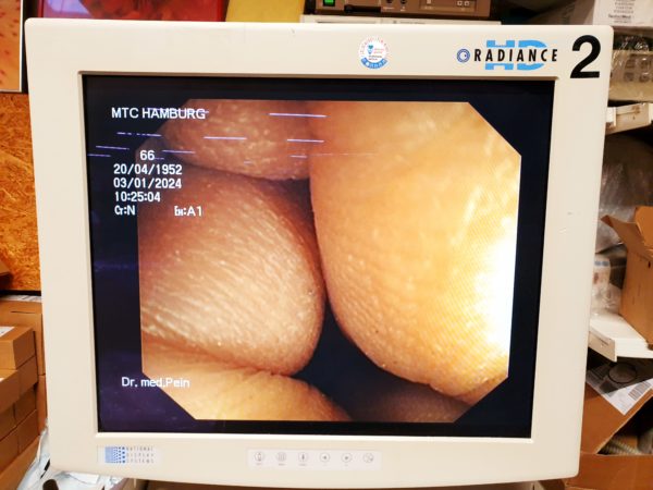 Olympus CF-Q160 I Koloskop – Bild 4