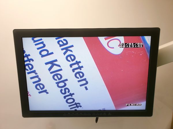 Pentax PSV-4000 Prozessor + Kamera – Bild 14