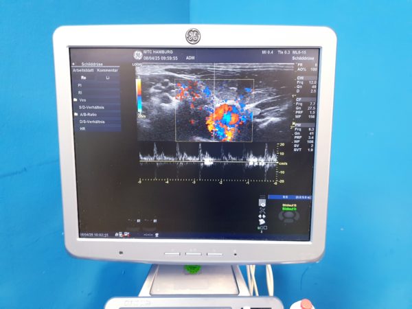 GE Logiq S8  + ML6-15  Linear + MS5-D Echo + C1-5 Konvex – Bild 12