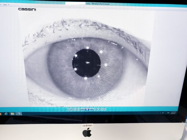 Cassini Corneal Topographer Type A  total corneal astigmatism – Bild 10