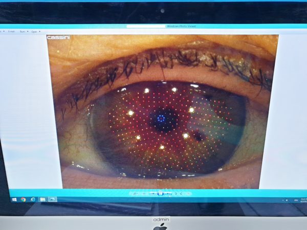 Cassini Corneal Topographer Type A  total corneal astigmatism – Bild 11