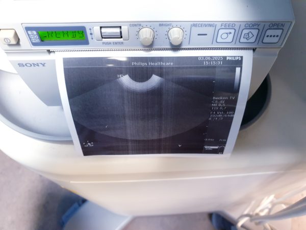 Philips HD 5 HD5 + C5-2 + C8-4v  + L12-3 – Gynmaschine  Farbdoppler – Bild 9