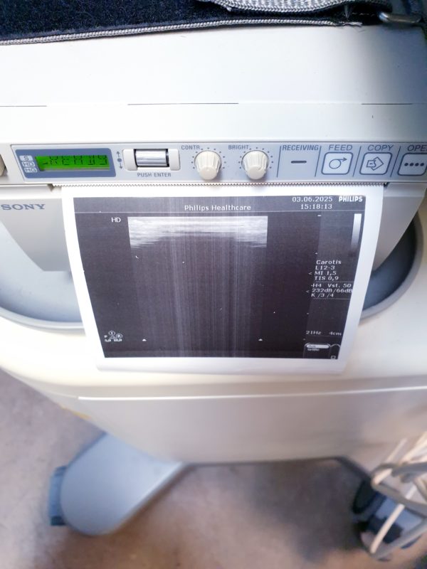 Philips HD 5 HD5 + C5-2 + C8-4v  + L12-3 – Gynmaschine  Farbdoppler – Bild 14