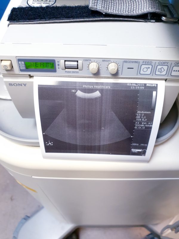 Philips HD 5 HD5 + C5-2 + C8-4v  + L12-3 – Gynmaschine  Farbdoppler – Bild 18