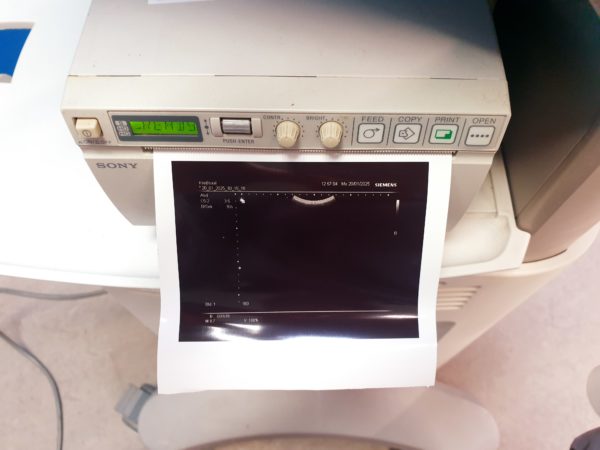 Siemens  C5-2  Ultraschall Ultrasound Probe Sonde - defekt – Bild 5