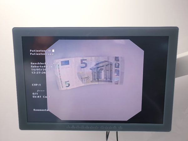 Olympus TJF-160VR TJF 160 VR Videoduodenoskop – Bild 17