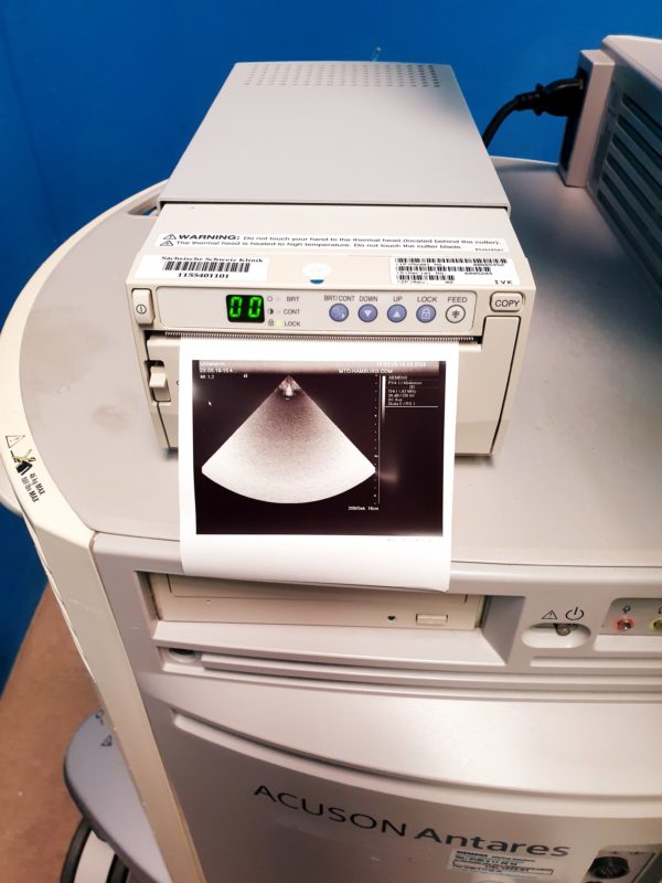 Siemens Acuson Antares Fahrdoppler Doppler + CH4-1 + VFX10-5 + PX4-1 Kardio – Bild 10