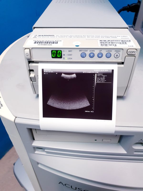 Siemens Acuson Antares Fahrdoppler Doppler + CH4-1 + VFX10-5 + PX4-1 Kardio – Bild 20