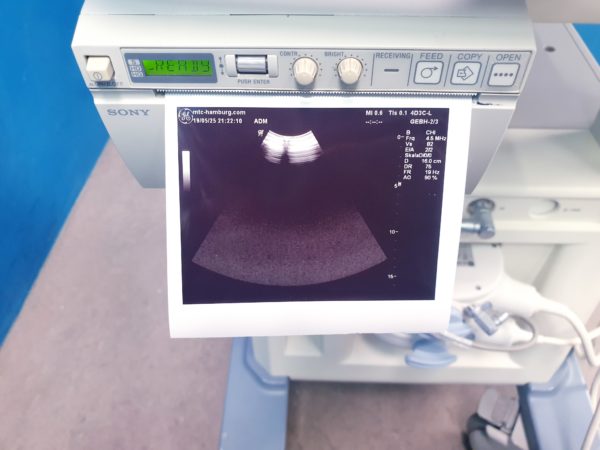 GE Logiq P5 – 4D3C-L + E8C 3D  4D Ultraschallgerät – Bild 12