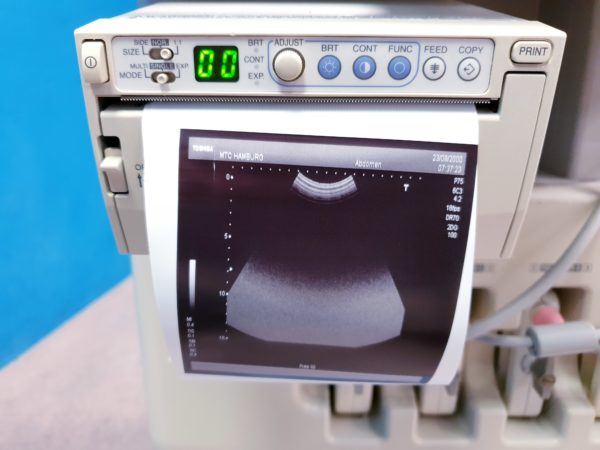 TOSHIBA NEMIO 20 SSA-550A Farbdoppler Ultraschallgerät mit 4 Sonden - und Printer – Bild 10