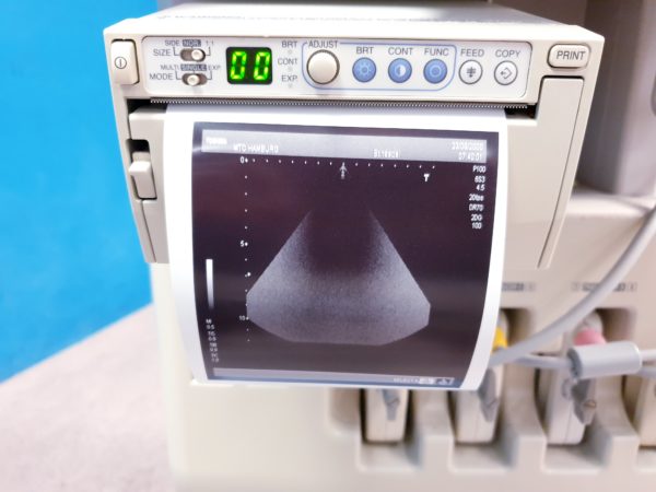 TOSHIBA NEMIO 20 SSA-550A Farbdoppler Ultraschallgerät mit 4 Sonden - und Printer – Bild 15