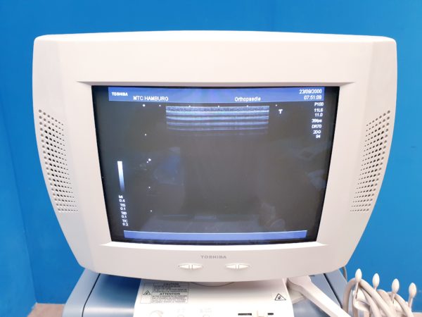 TOSHIBA NEMIO 20 SSA-550A Farbdoppler Ultraschallgerät mit 4 Sonden - und Printer – Bild 24
