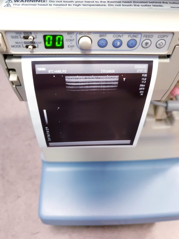 TOSHIBA NEMIO 20 SSA-550A Farbdoppler Ultraschallgerät mit 4 Sonden - und Printer – Bild 25