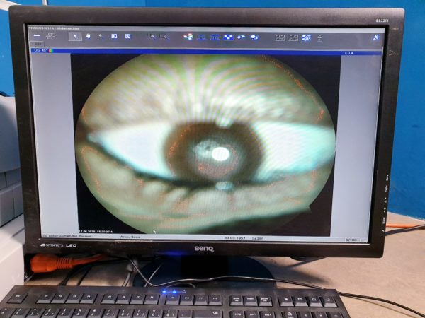 Carl zeiss Visucam NM FM  Funduskamera – Bild 5