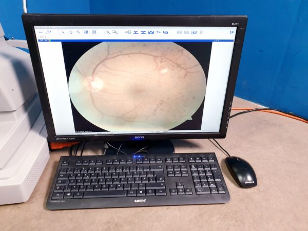 Carl zeiss Visucam NM FM  Funduskamera – Bild 8