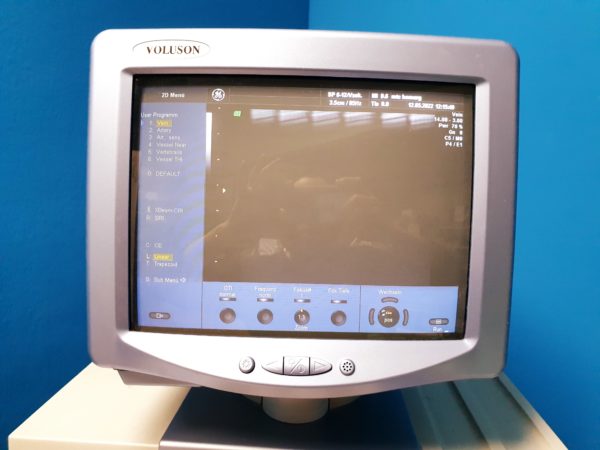 GE VOLUSON 730 Pro  730Pro + RAB4-8L + SP6-12 + IC5-9H + PA6-8 – Bild 15