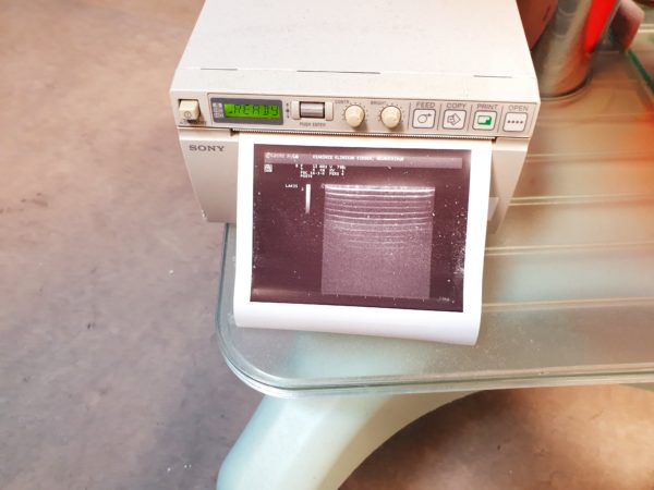 Esaote LA435 Linear Array Ultrasound Lineare Sonde AH042025-K – Bild 4