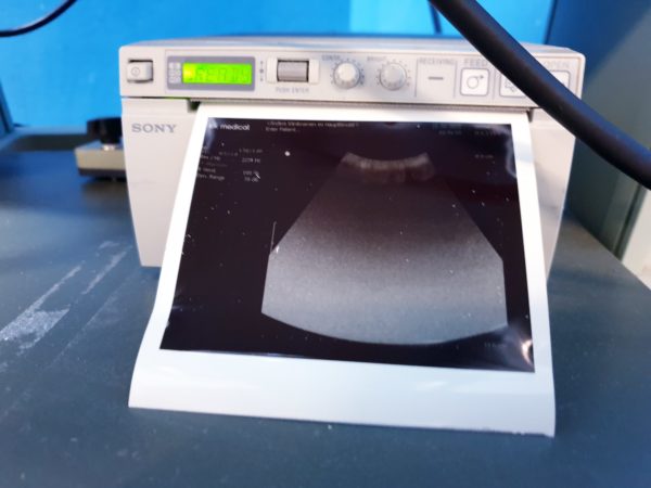 BK Medical  2202 + 8820e Konvex  + 8811  Linear  Ultraschallgerät – Bild 8
