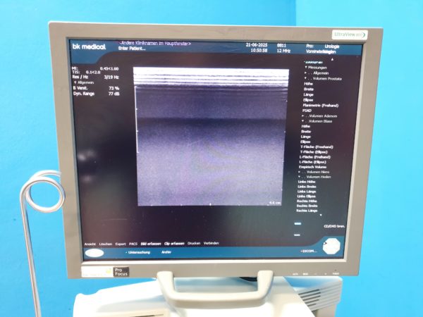 BK Medical  2202 + 8820e Konvex  + 8811  Linear  Ultraschallgerät – Bild 11