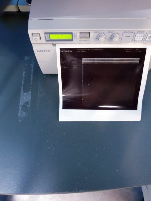 BK Medical  2202 + 8820e Konvex  + 8811  Linear  Ultraschallgerät – Bild 12