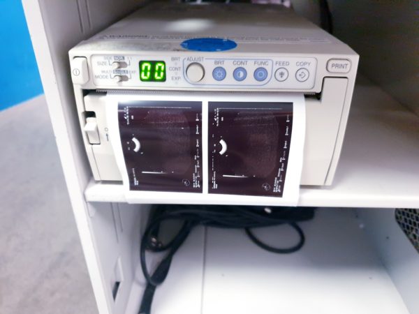 Pentax EG-3870UTK Linear Array Ultrasound Endoscopy Gastroscope – Bild 21