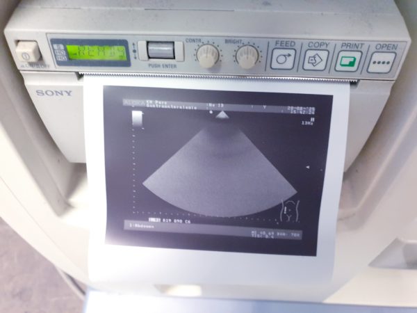 Aloka UST-52101 52101  Kardio – Echosonde – Bild 5