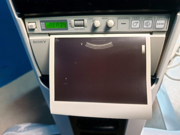 GE Vivid S5 Kardiomaschine +   8L-RS  3S-RS  4C-RS – Bild 9