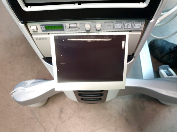 GE Vivid S5 Kardiomaschine +   8L-RS  3S-RS  4C-RS – Bild 17