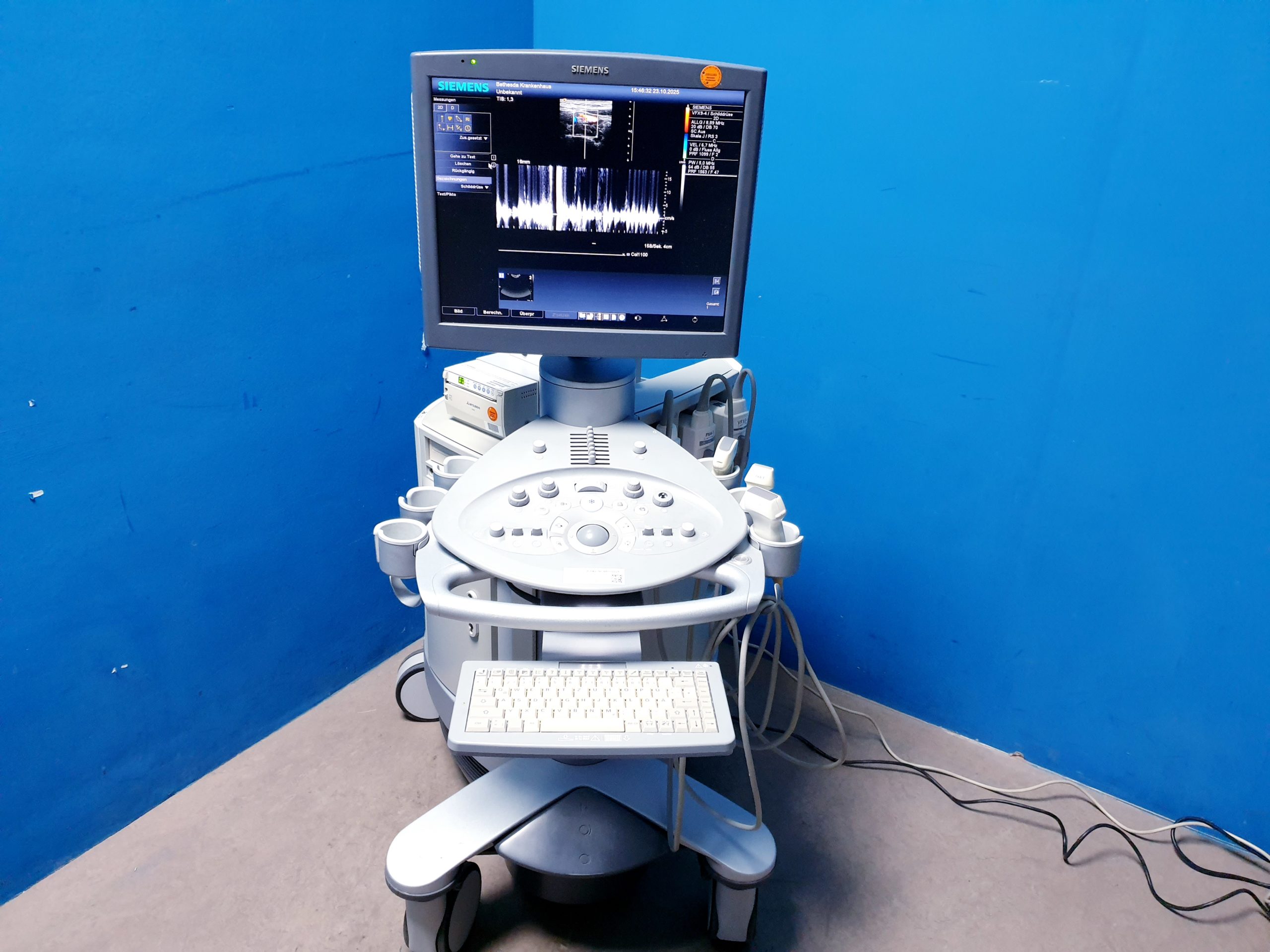 Siemens Acuson Antares Ultraschall Gerät mit 3 Sonden CH4-1 + PX4-1 + VFX9-4 – Bild 4