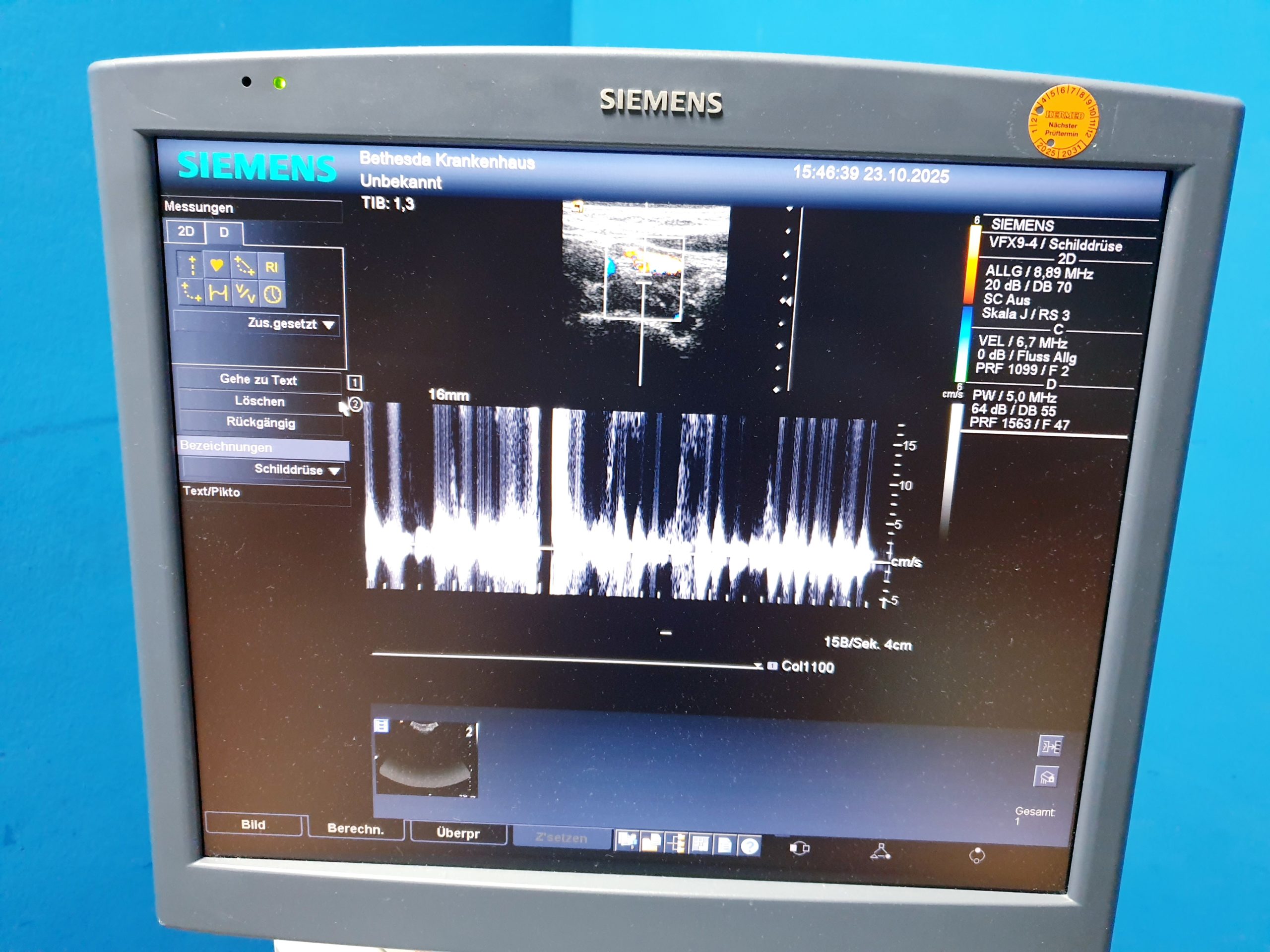 Siemens Acuson Antares Ultraschall Gerät mit 3 Sonden CH4-1 + PX4-1 + VFX9-4 – Bild 5