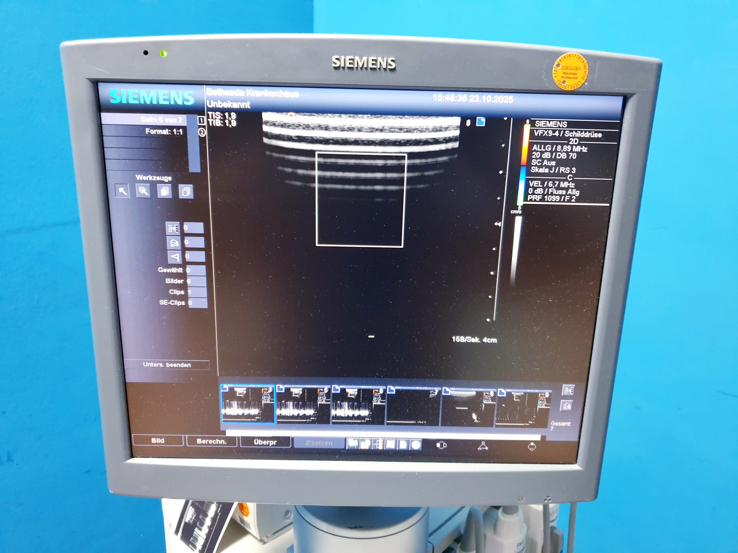 Siemens Acuson Antares Ultraschall Gerät mit 3 Sonden CH4-1 + PX4-1 + VFX9-4 – Bild 7