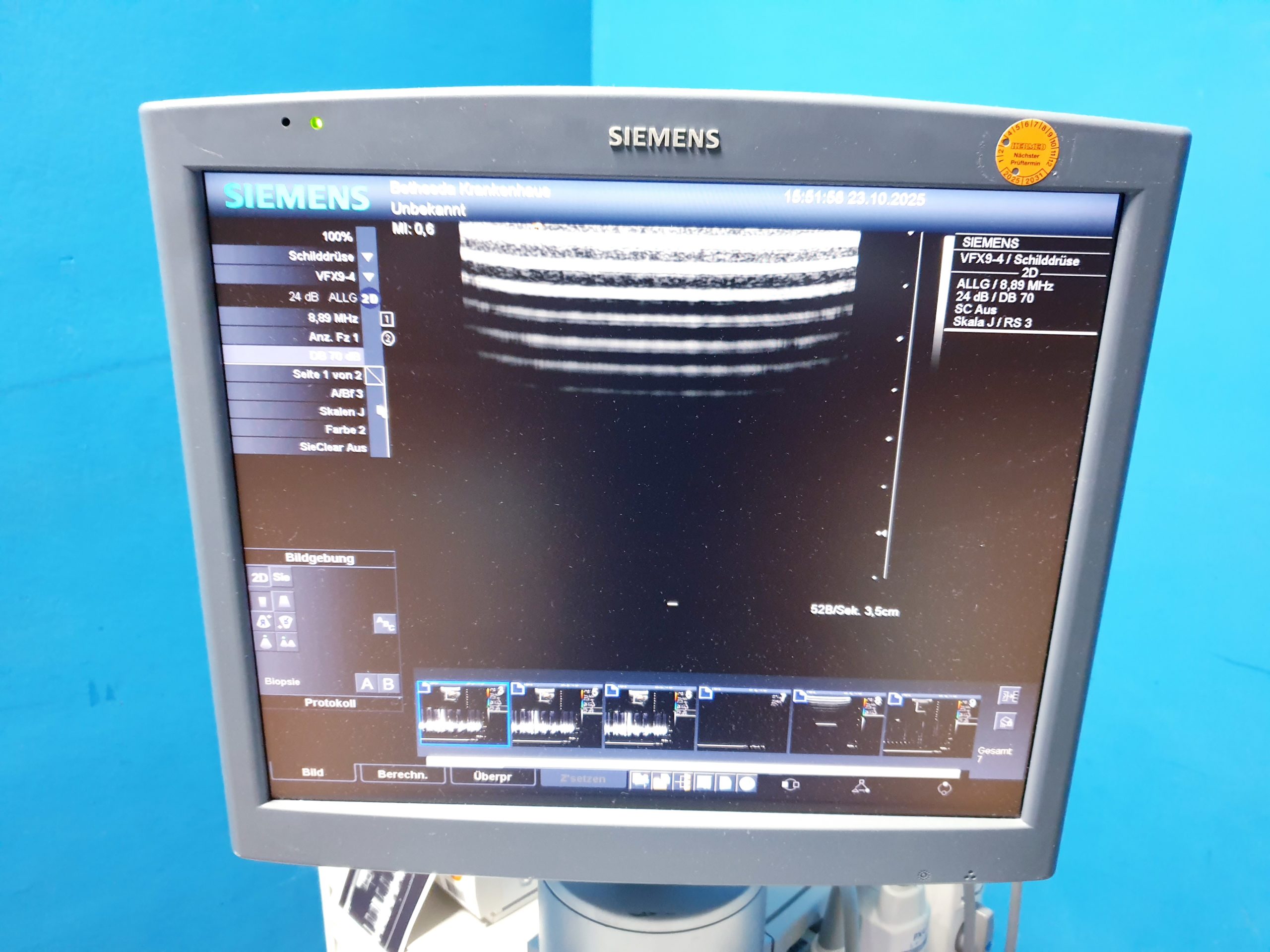 Siemens Acuson Antares Ultraschall Gerät mit 3 Sonden CH4-1 + PX4-1 + VFX9-4 – Bild 13