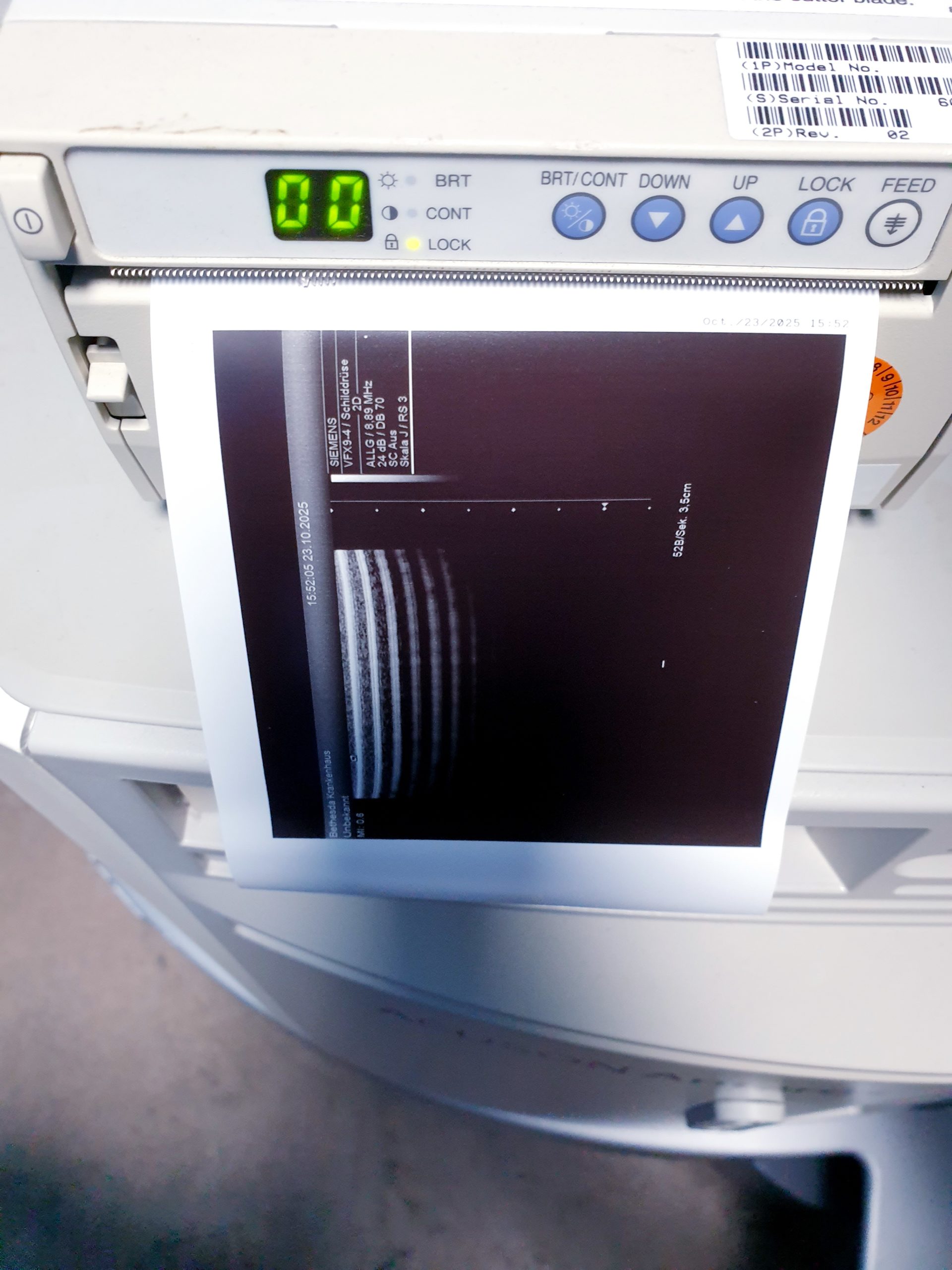 Siemens Acuson Antares Ultraschall Gerät mit 3 Sonden CH4-1 + PX4-1 + VFX9-4 – Bild 14