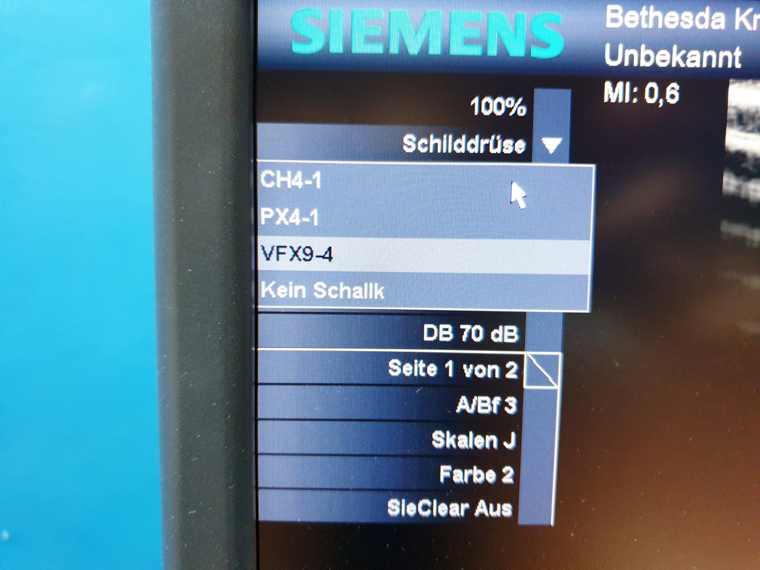 Siemens Acuson Antares Ultraschall Gerät mit 3 Sonden CH4-1 + PX4-1 + VFX9-4 – Bild 17