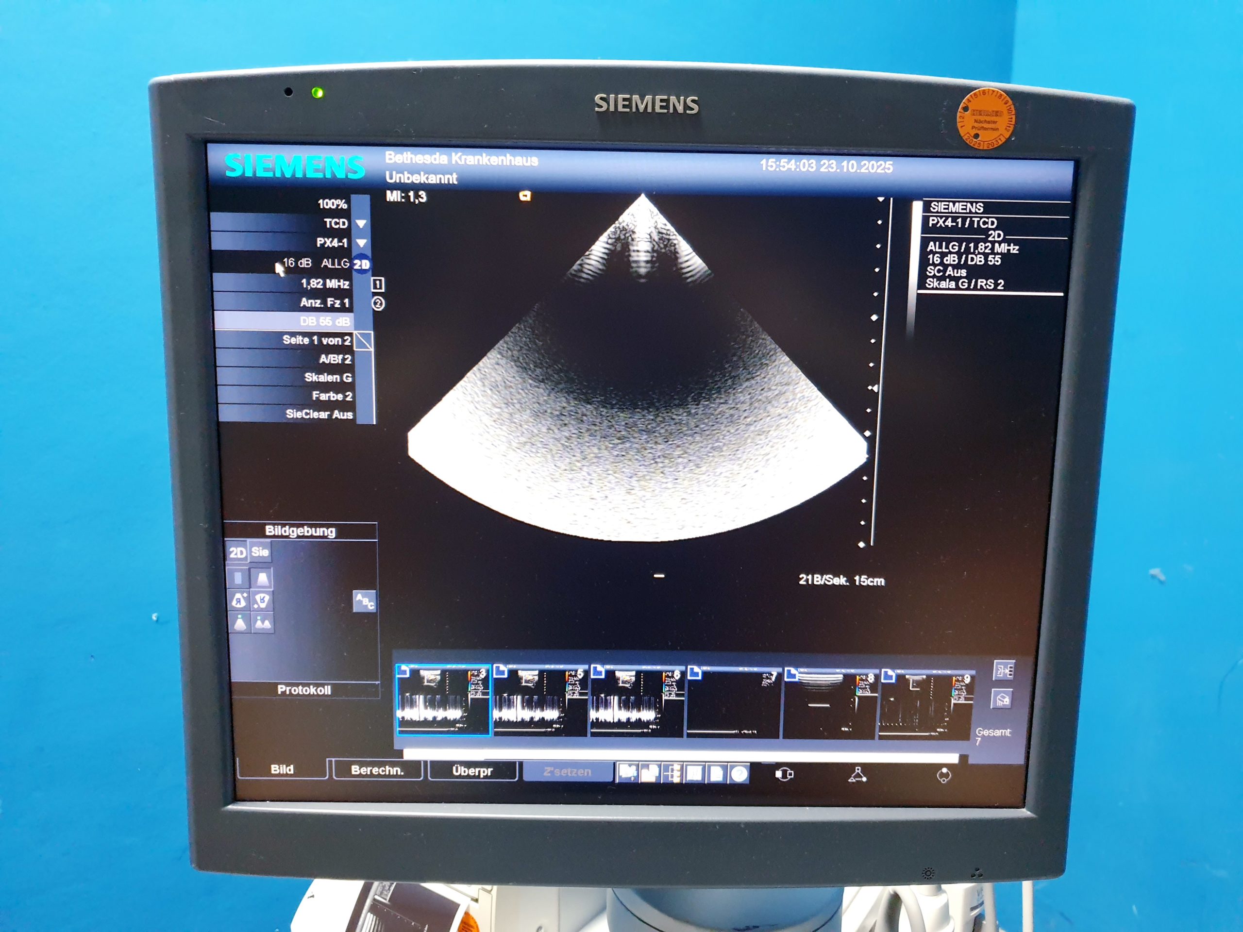 Siemens Acuson Antares Ultraschall Gerät mit 3 Sonden CH4-1 + PX4-1 + VFX9-4 – Bild 19