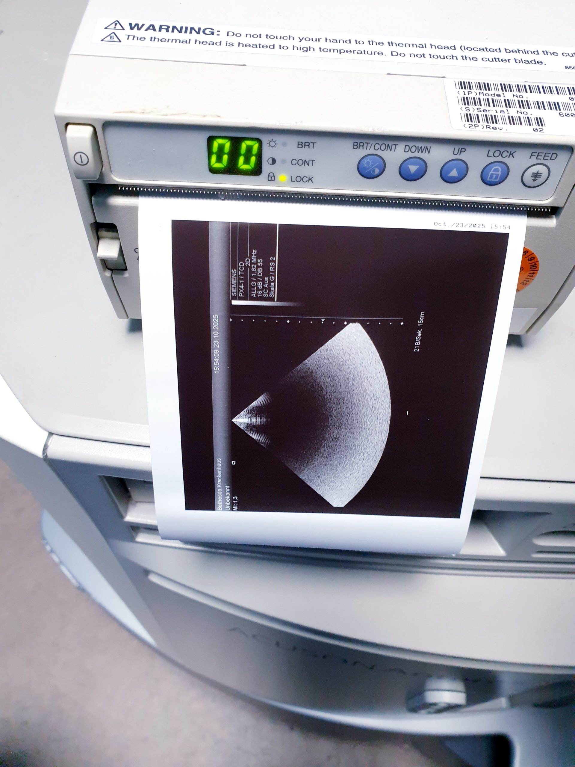 Siemens Acuson Antares Ultraschall Gerät mit 3 Sonden CH4-1 + PX4-1 + VFX9-4 – Bild 20