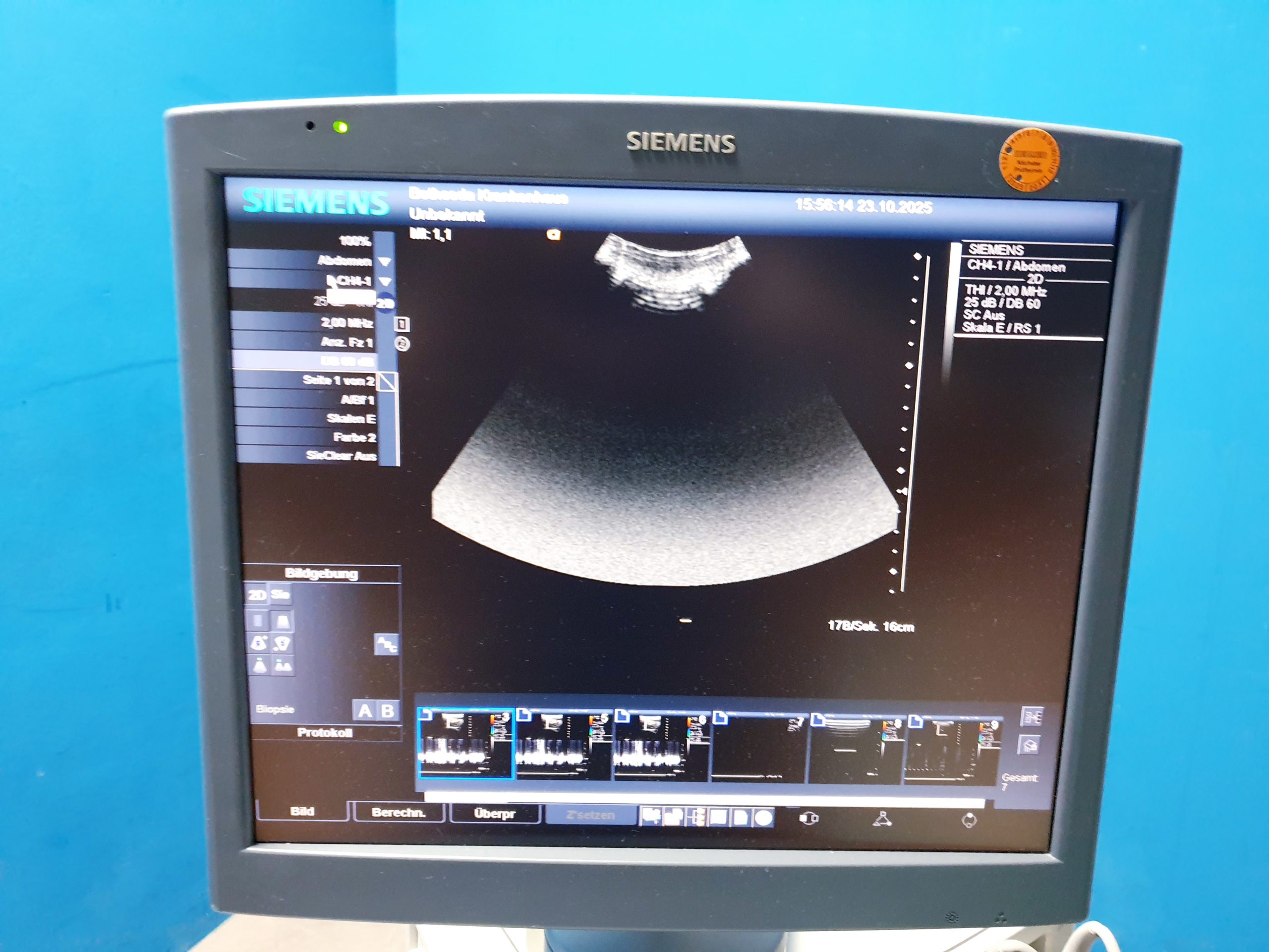 Siemens Acuson Antares Ultraschall Gerät mit 3 Sonden CH4-1 + PX4-1 + VFX9-4 – Bild 23