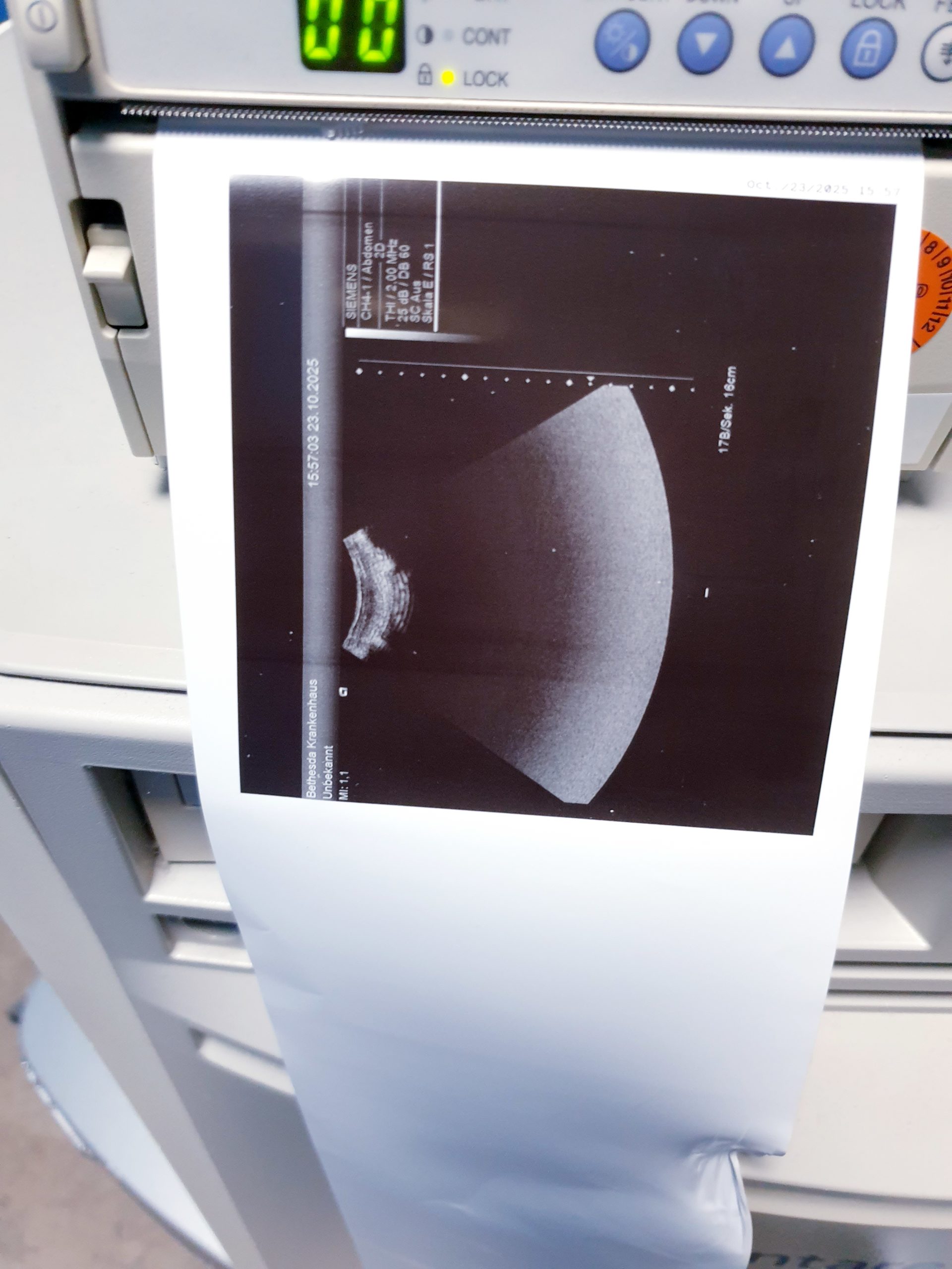 Siemens Acuson Antares Ultraschall Gerät mit 3 Sonden CH4-1 + PX4-1 + VFX9-4 – Bild 24