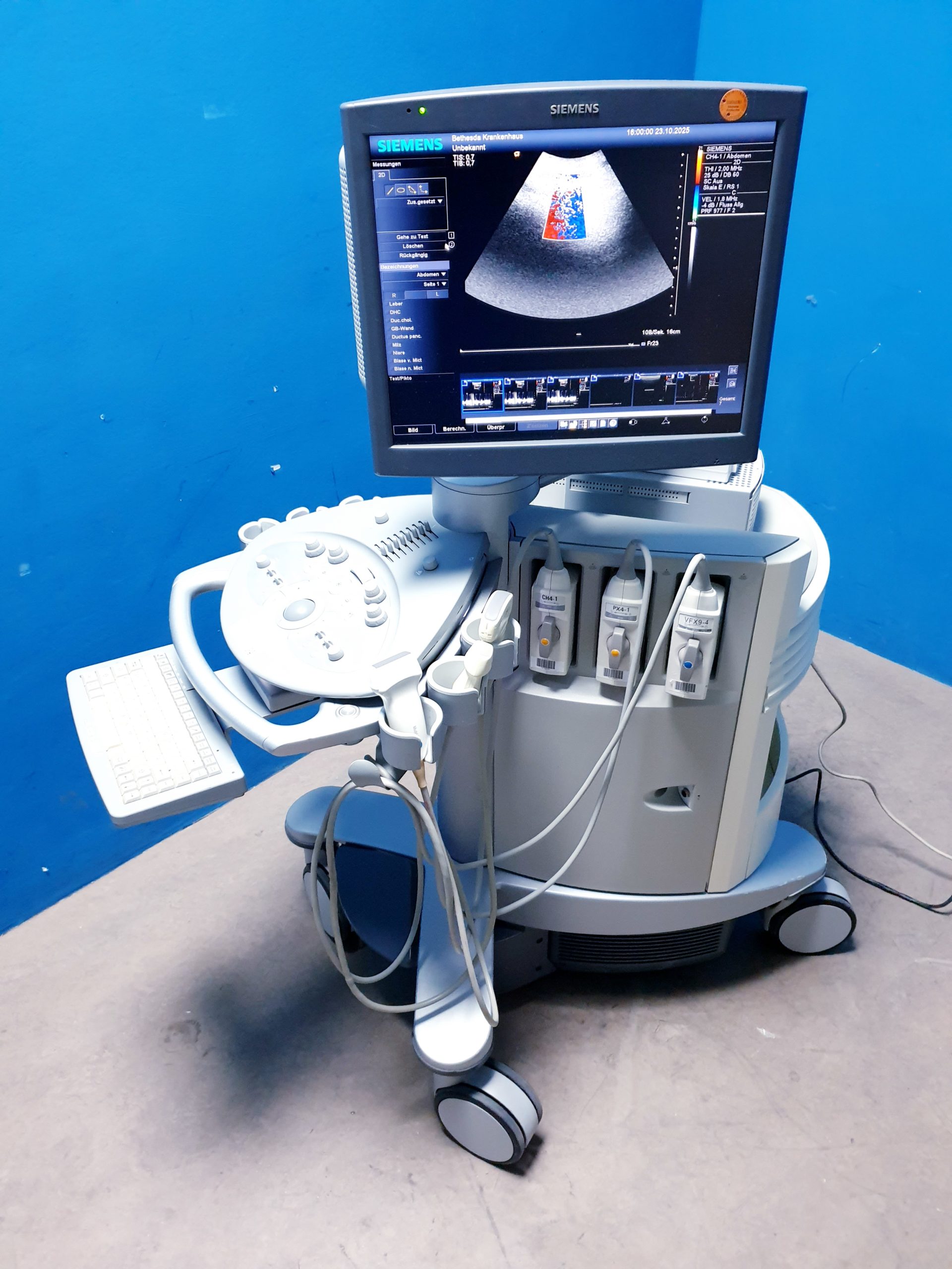 Siemens Acuson Antares Ultraschall Gerät mit 3 Sonden CH4-1 + PX4-1 + VFX9-4 – Bild 25